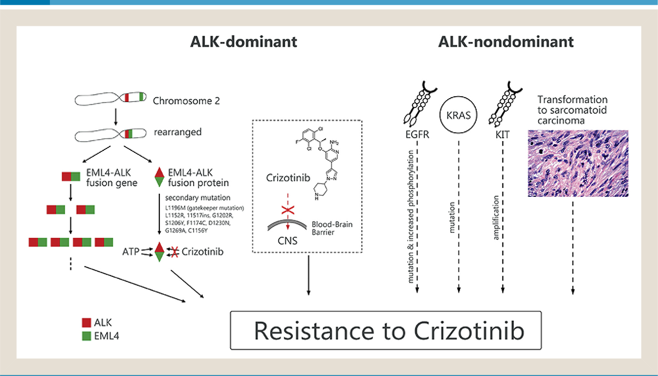 影响克唑替尼(Crizotinib)疗效的因素有哪些(图3)