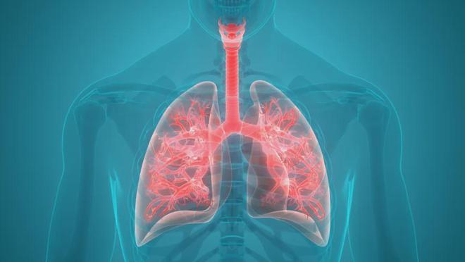 肺癌出现便秘怎么办?(图1)