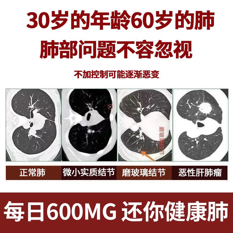 德国槲皮素清肺胶囊60粒装 清烟肺肺结节呼吸不畅止咳清痰润肺养肺保健品 德国槲皮素肺结节胶囊