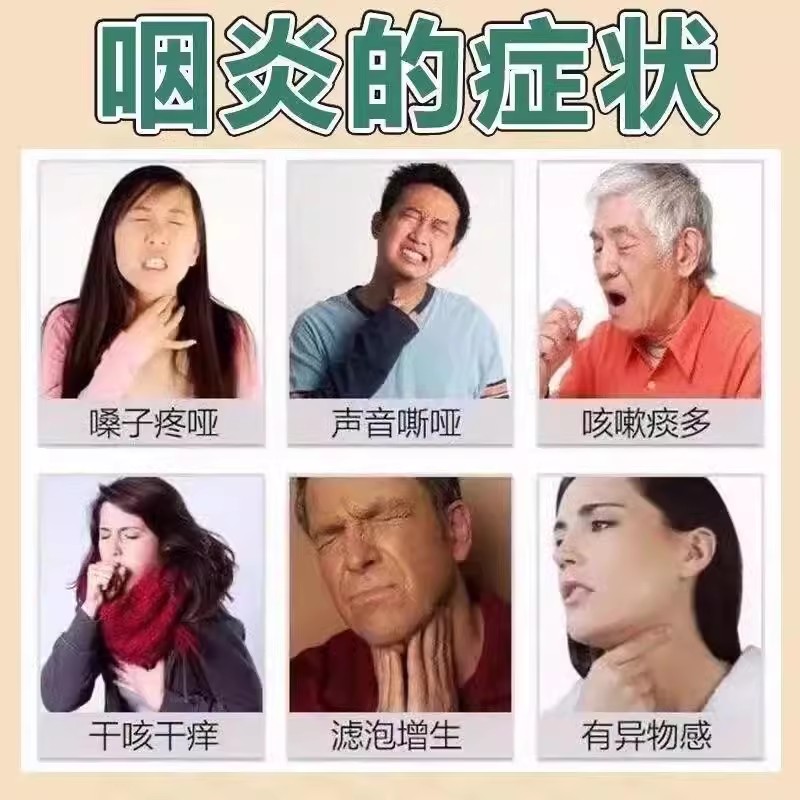 咽喉炎特效的药100片装 咽喉肿痛急性咽炎扁桃体炎清热解毒 冬凌草片咽炎专用特效慢性咽炎除根