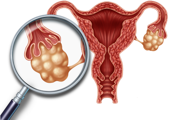 卵巢癌有腰痛可否用华蟾素胶囊?(图1)