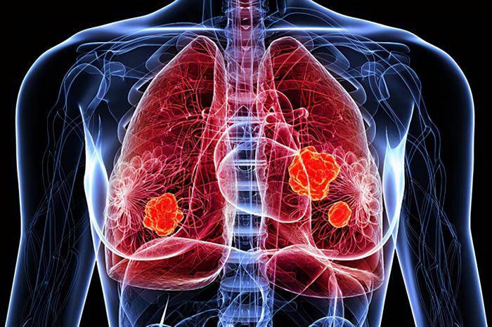肺癌术后白细胞一直低下,现转肝,子宫乳腺,用胸腺肽有帮助吗?(图1)