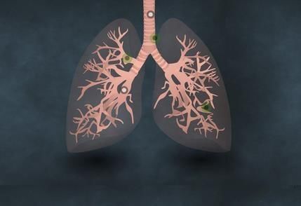 肺鳞癌用恩度和阿帕替尼效果如何(图1)