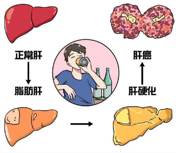 肝癌用阿可拉定效果如何?可以单独使用吗(图1)